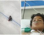 12 Year Old Boy Undergoes Successful Surgery To Remove Bullet Lodged In Heart