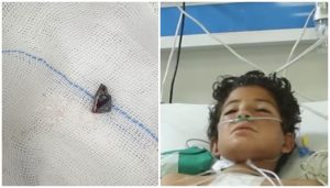 12 Year Old Boy Undergoes Successful Surgery To Remove Bullet Lodged In Heart