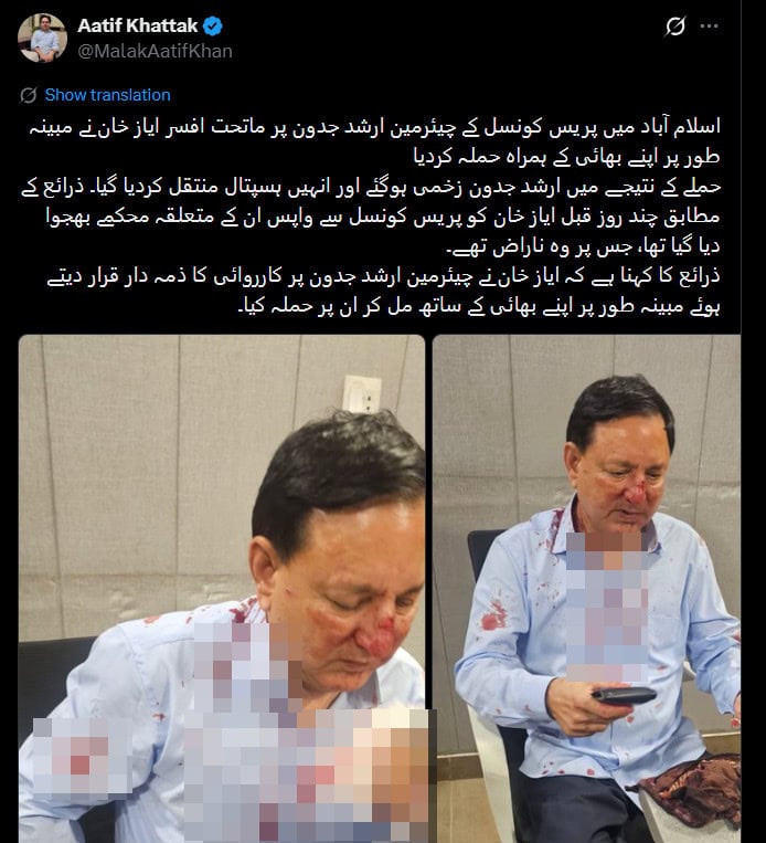 Press Council Chairman Arshad Jadoon Assaulted In Islamabad 