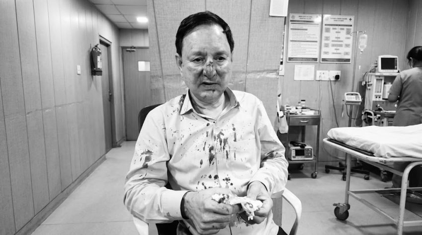 Press Council Chairman Arshad Jadoon Assaulted In Islamabad